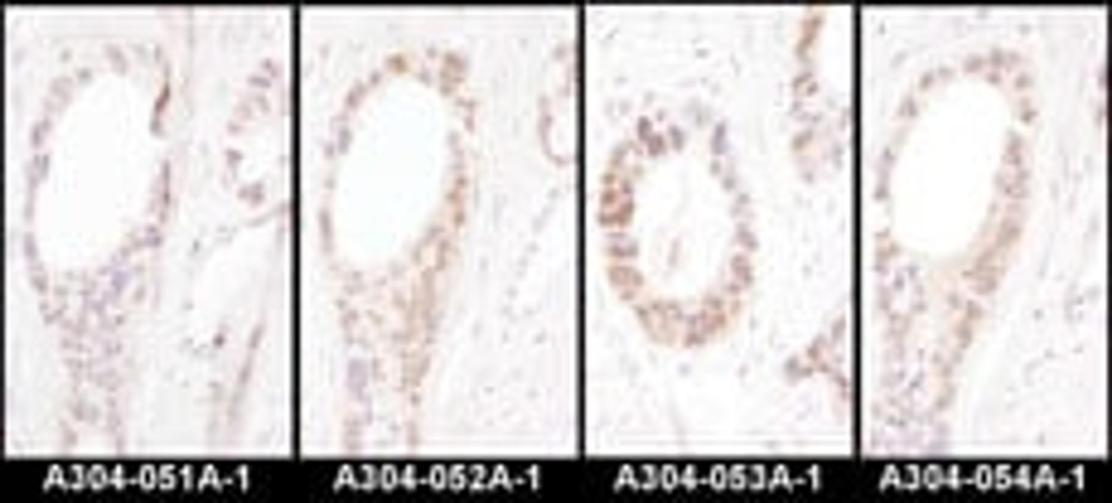 Detection of human HNF1-alpha by immunohistochemistry.