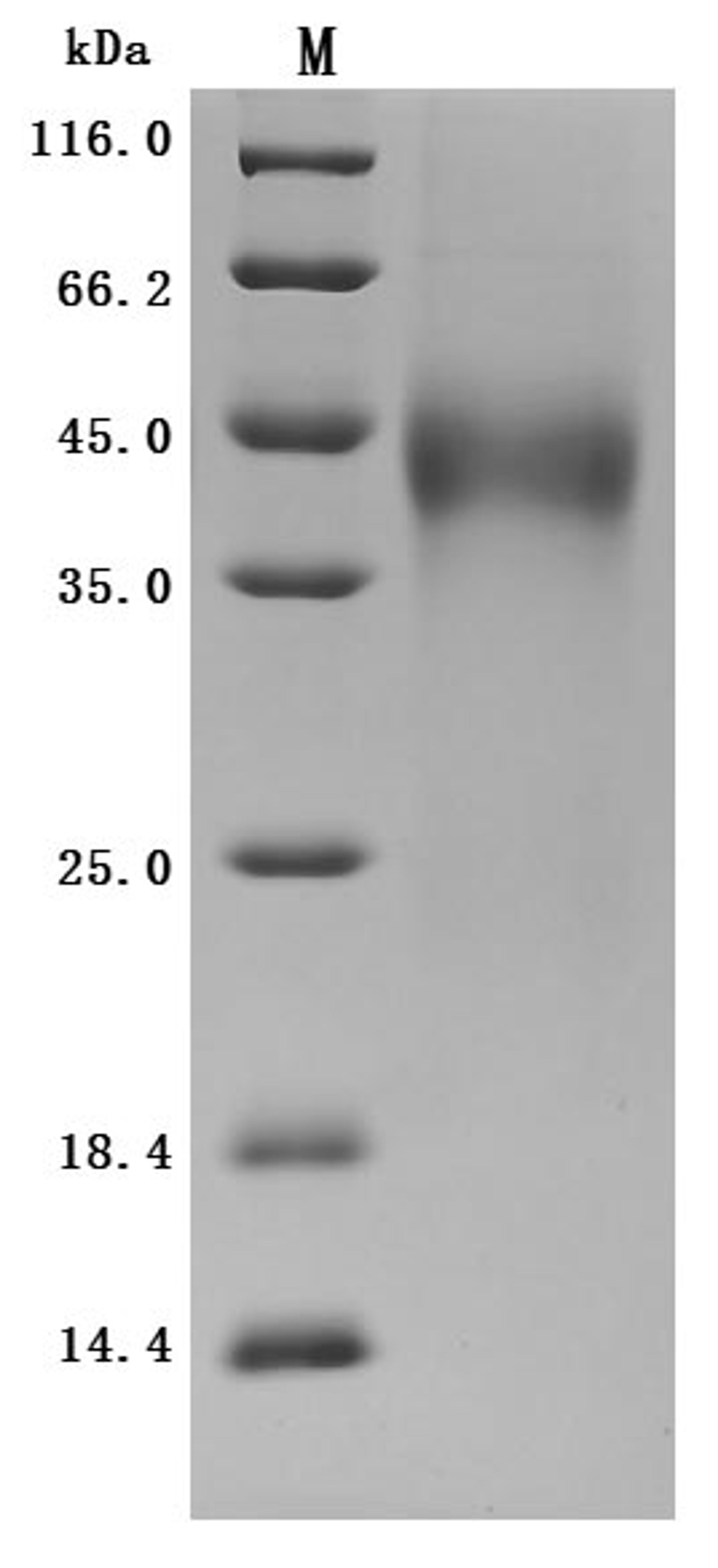 (Tris-Glycine gel) Discontinuous SDS-PAGE (reduced) with 5% enrichment gel and 15% separation gel.