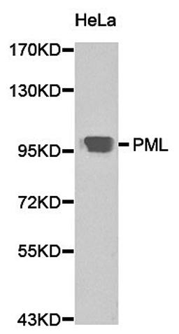 Western blot analysis of Hela cell lysate using PML antibody.