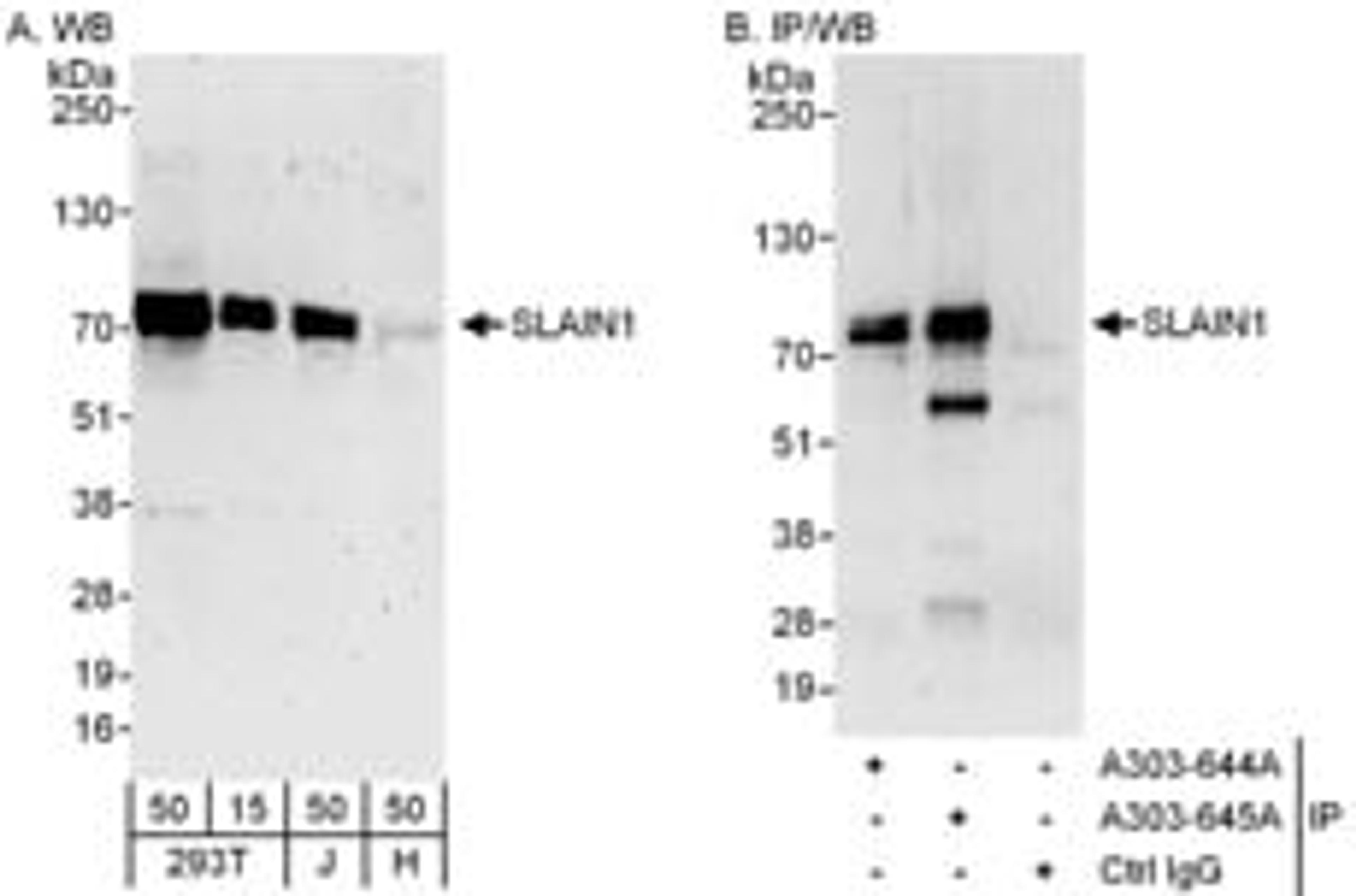 Detection of human SLAIN1 by western blot and immunoprecipitation.