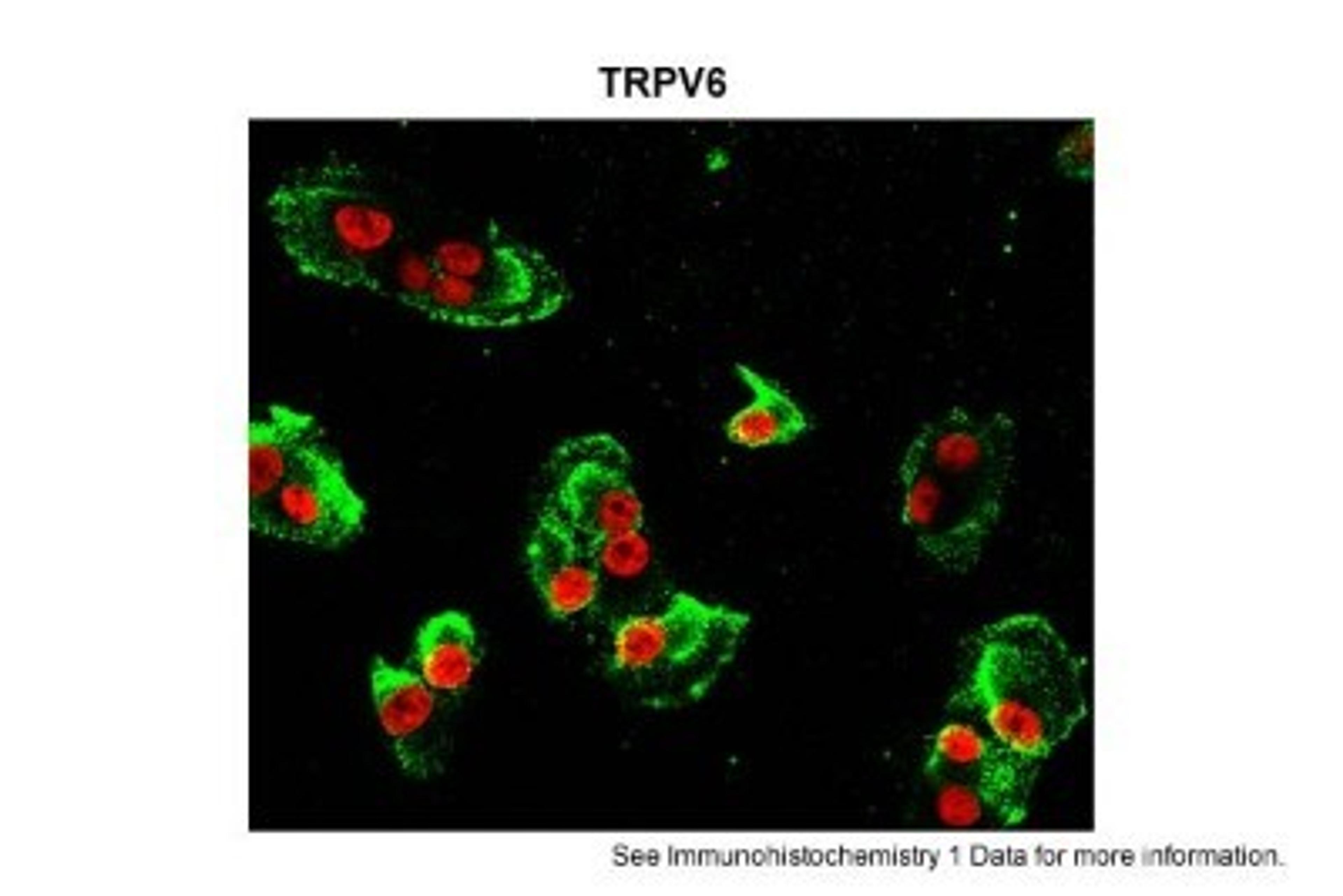 Immunocytochemistry/Immunofluorescence: TRPV6 Antibody [NBP1-74138] - hRetinal pigment epithelial cells Green: primary Red: nuclear Primary Dilution: 1:200 Secondary Antibody: goat anti-rabbit-Alexa 488 Secondary Dilution: 1:500 Image Submitted by: Brian Kennedy Indiana University Northwest