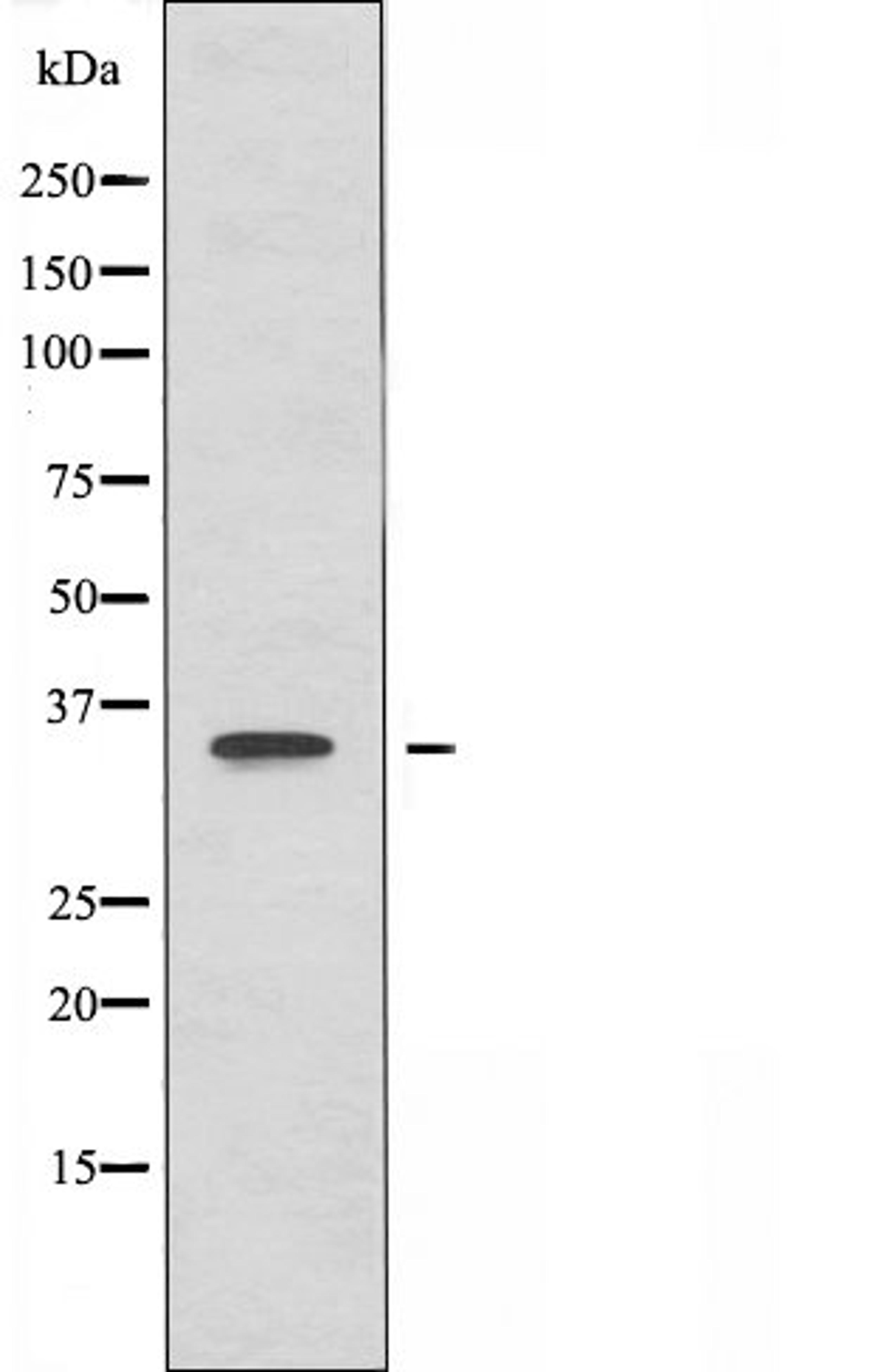 Western blot analysis of HepG2 cells and HeLa cells using OR52E4 antibody