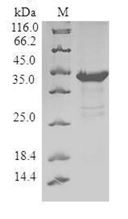 (Tris-Glycine gel) Discontinuous SDS-PAGE (reduced) with 5% enrichment gel and 15% separation gel.