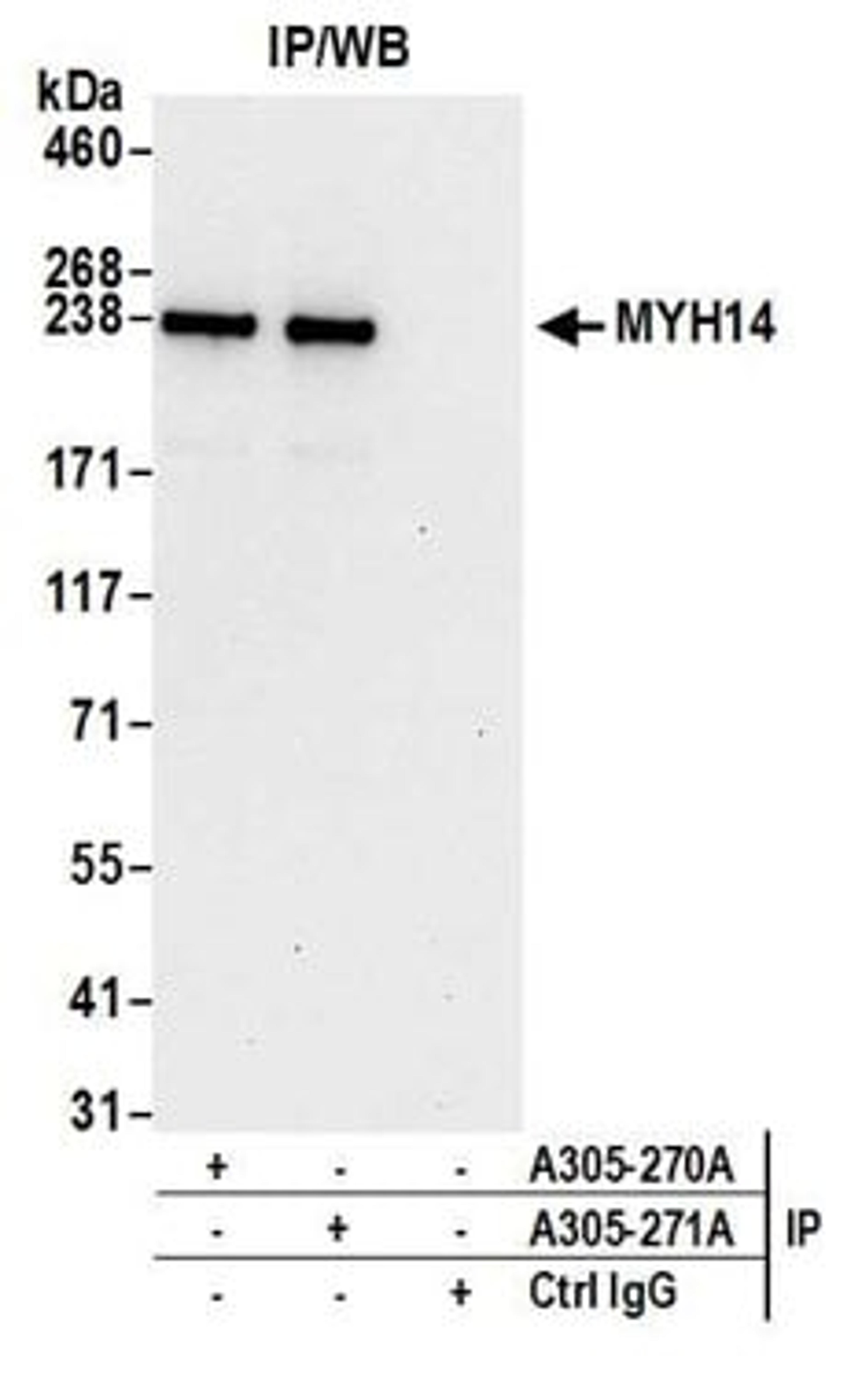 Detection of human MYH14 by western blot of immunoprecipitates.