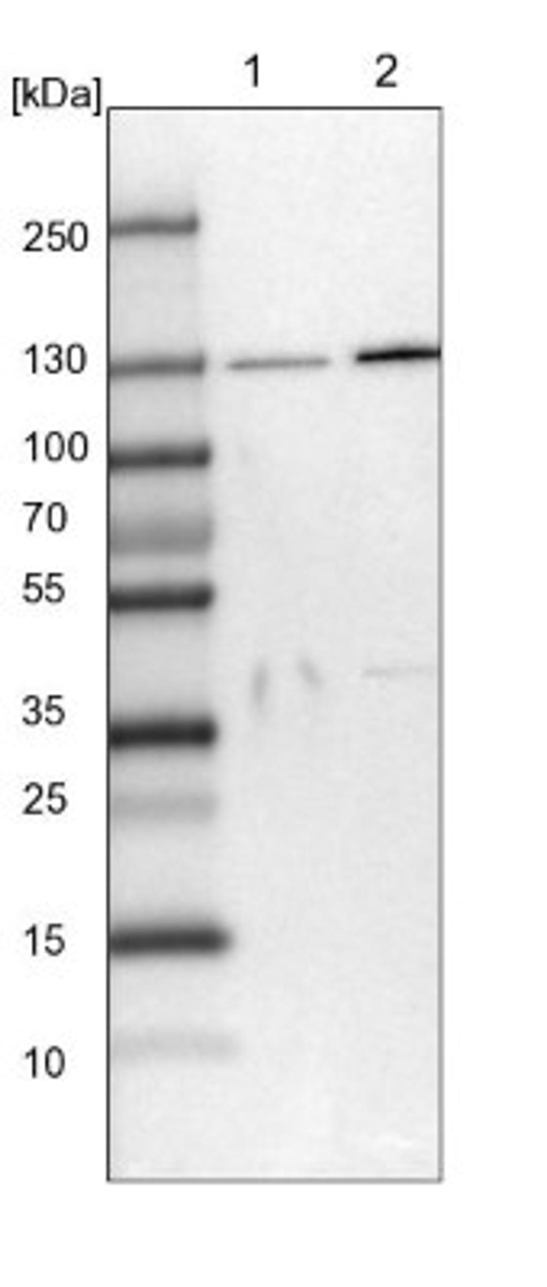 Western Blot: SEC23IP Antibody [NBP1-82456] - Lane 1: NIH-3T3 cell lysate (Mouse embryonic fibroblast cells)<br/>Lane 2: NBT-II cell lysate (Rat Wistar bladder tumour cells)