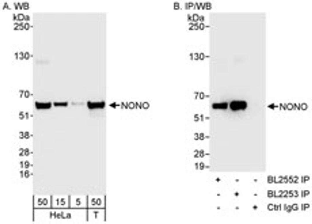 Detection of human NONO by western blot and immunoprecipitation.