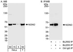 Detection of human NONO by western blot and immunoprecipitation.