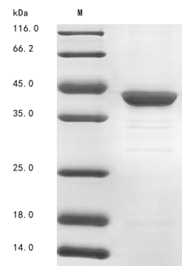 (Tris-Glycine gel) Discontinuous SDS-PAGE (reduced) with 5% enrichment gel and 15% separation gel.