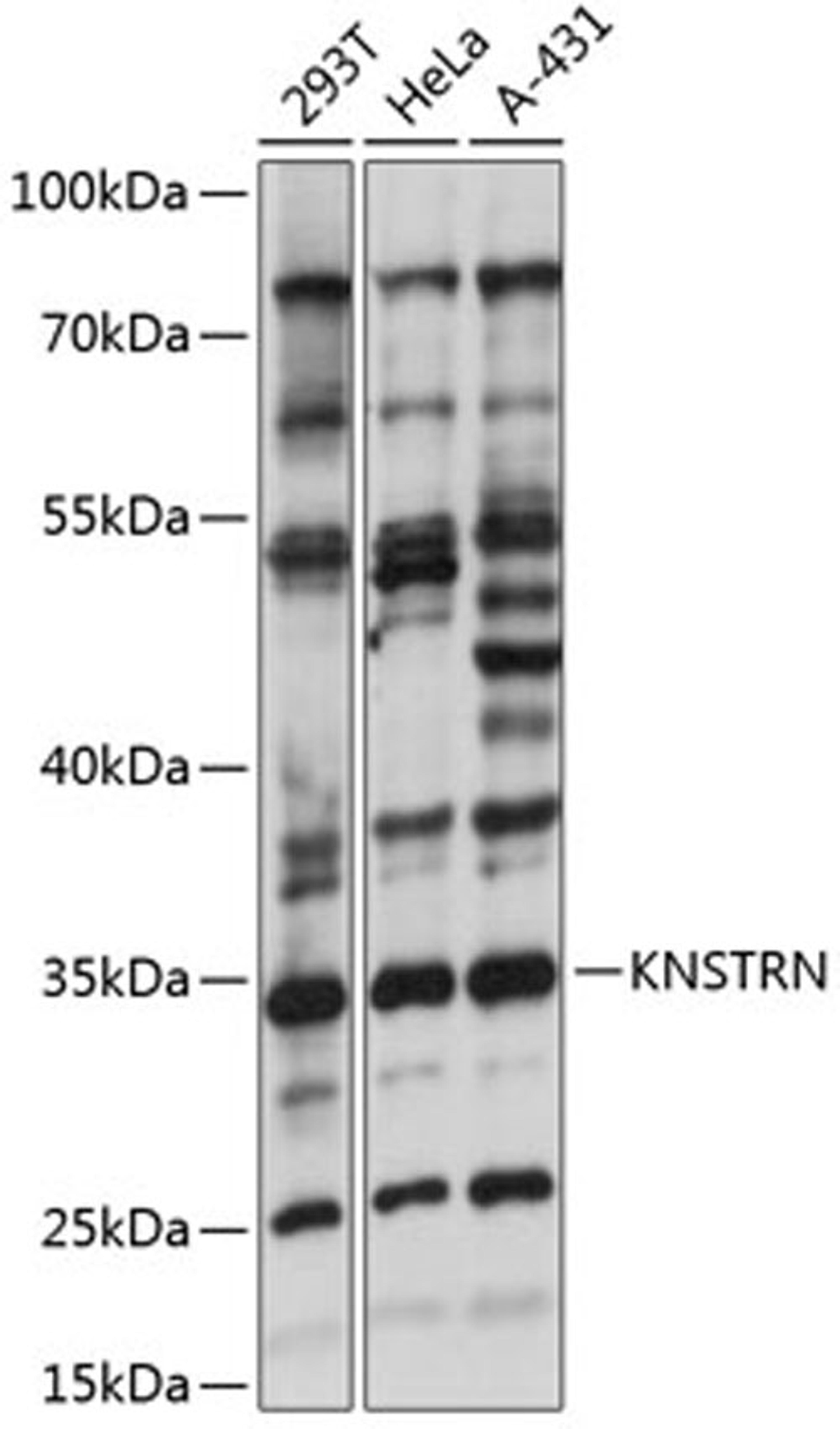 Western blot - KNSTRN antibody (A14306)