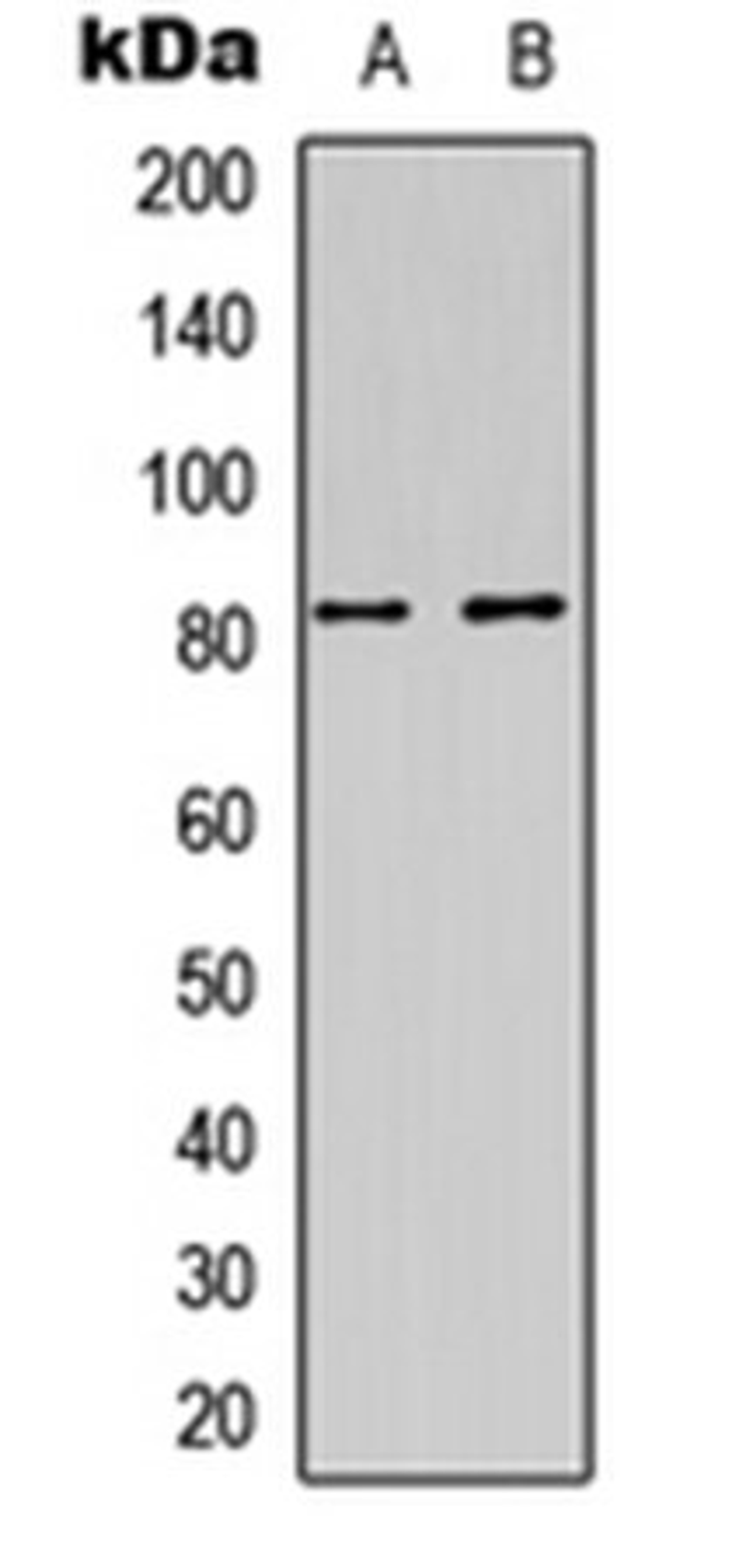 Western blot analysis of HEK293T (Lane 1), HeLa (Lane 2) whole cell lysates using DAXX (phospho-S668) antibody