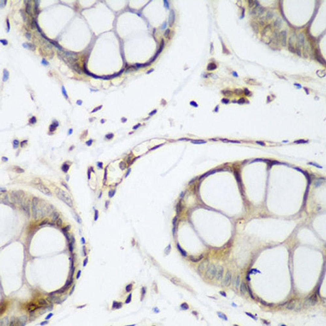 Immunohistochemistry - TAZ antibody (A8202)