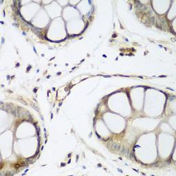 Immunohistochemistry - TAZ antibody (A8202)