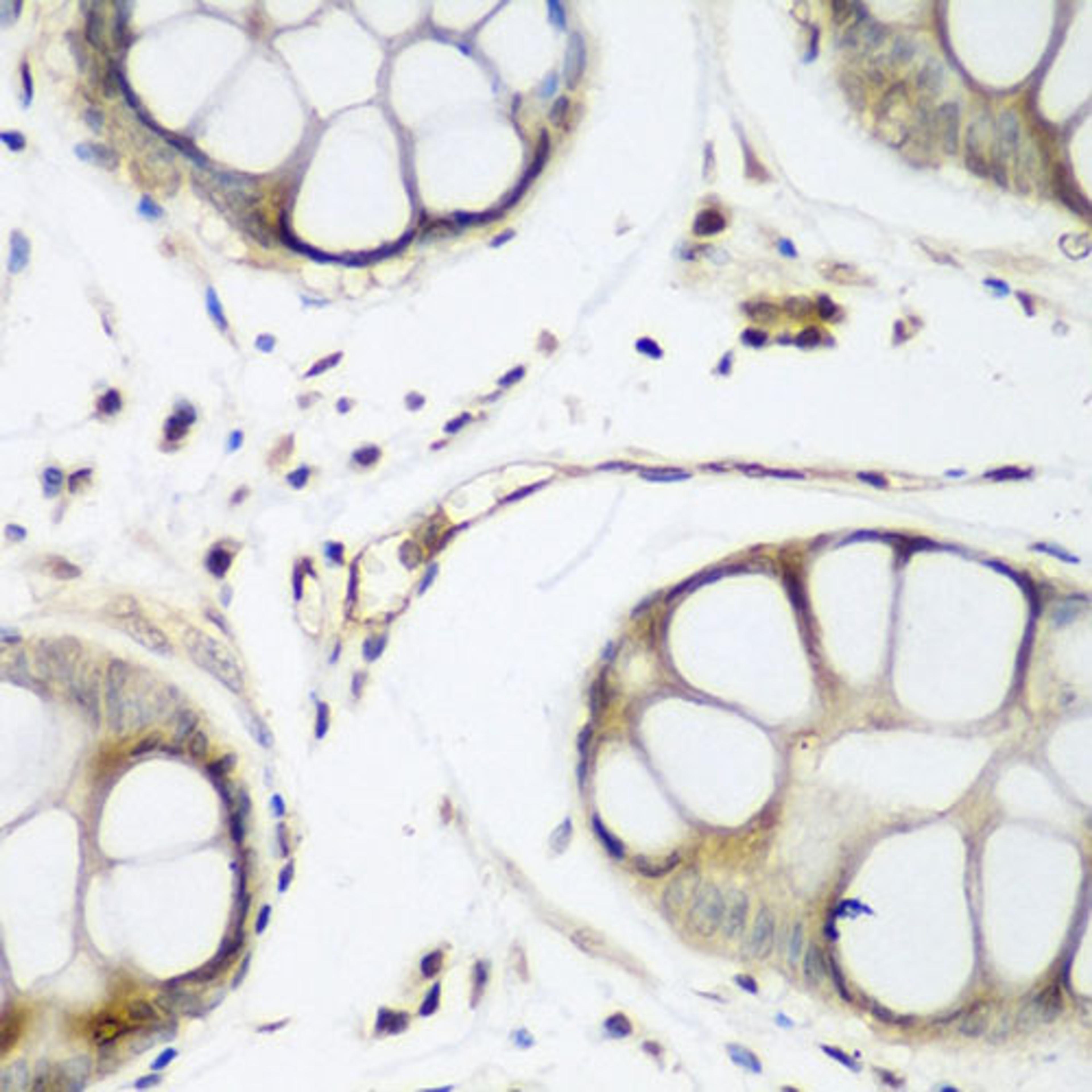 Immunohistochemistry - TAZ antibody (A8202)