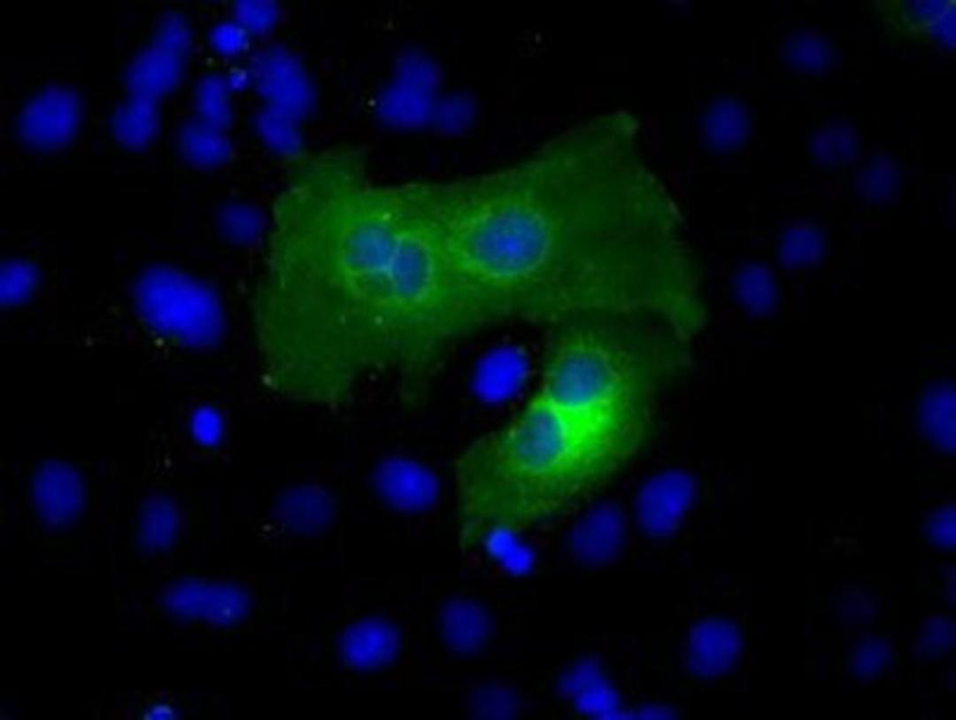 Immunocytochemistry/Immunofluorescence: ACSBG1 Antibody (1D8) [NBP2-02554] Staining of COS7 cells transiently transfected by pCMV6-ENTRY ACSBG1.