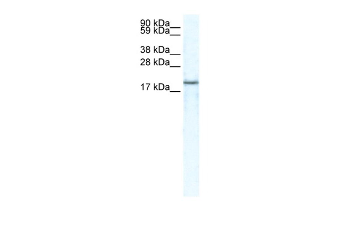 Antibody used in WB on Human Muscle at 5.0 ug/ml.