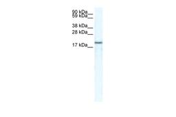 Antibody used in WB on Human Muscle at 5.0 ug/ml.