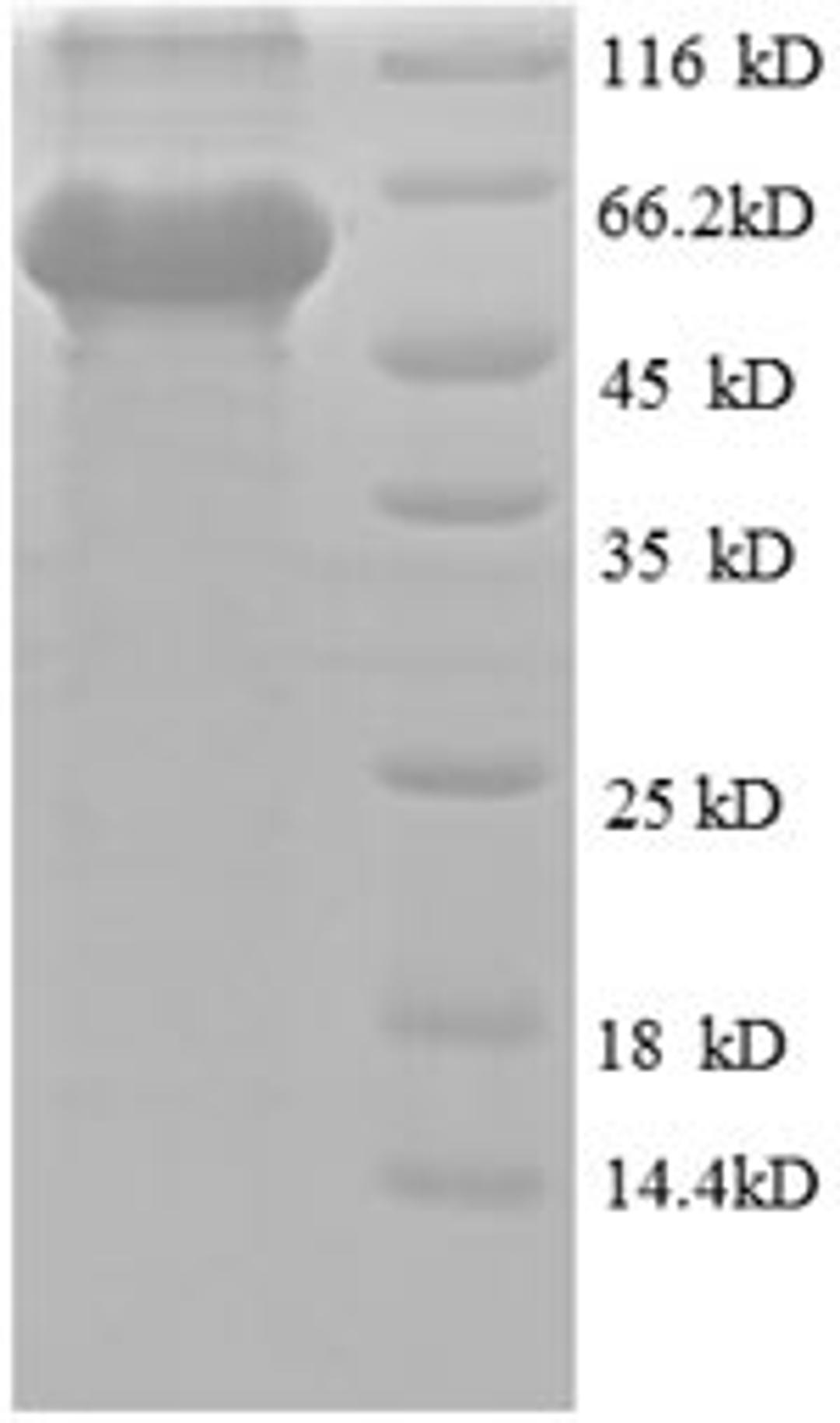 (Tris-Glycine gel) Discontinuous SDS-PAGE (reduced) with 5% enrichment gel and 15% separation gel.