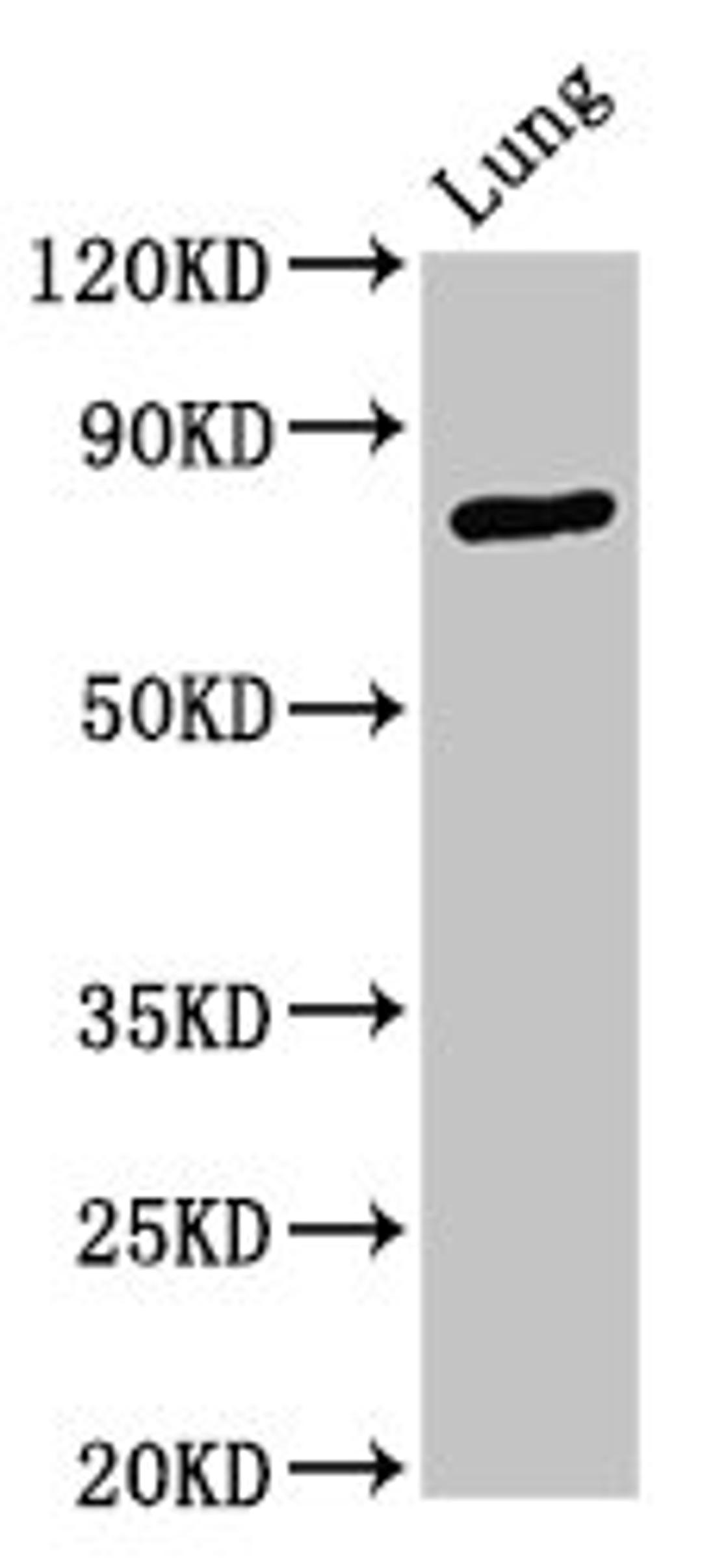 Western Blot. Positive WB detected in: Rat lung tissue. All lanes: ATXN7 antibody at 3.3ug/ml. Secondary. Goat polyclonal to rabbit IgG at 1/50000 dilution. Predicted band size: 96, 102, 80 kDa. Observed band size: 80 kDa.