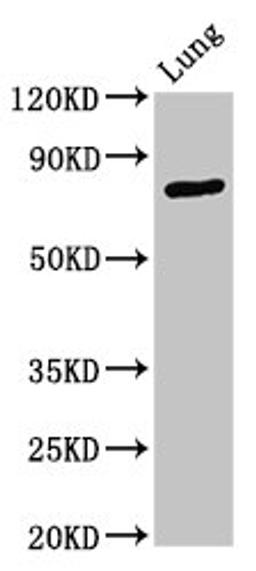 Western Blot. Positive WB detected in: Rat lung tissue. All lanes: ATXN7 antibody at 3.3ug/ml. Secondary. Goat polyclonal to rabbit IgG at 1/50000 dilution. Predicted band size: 96, 102, 80 kDa. Observed band size: 80 kDa.