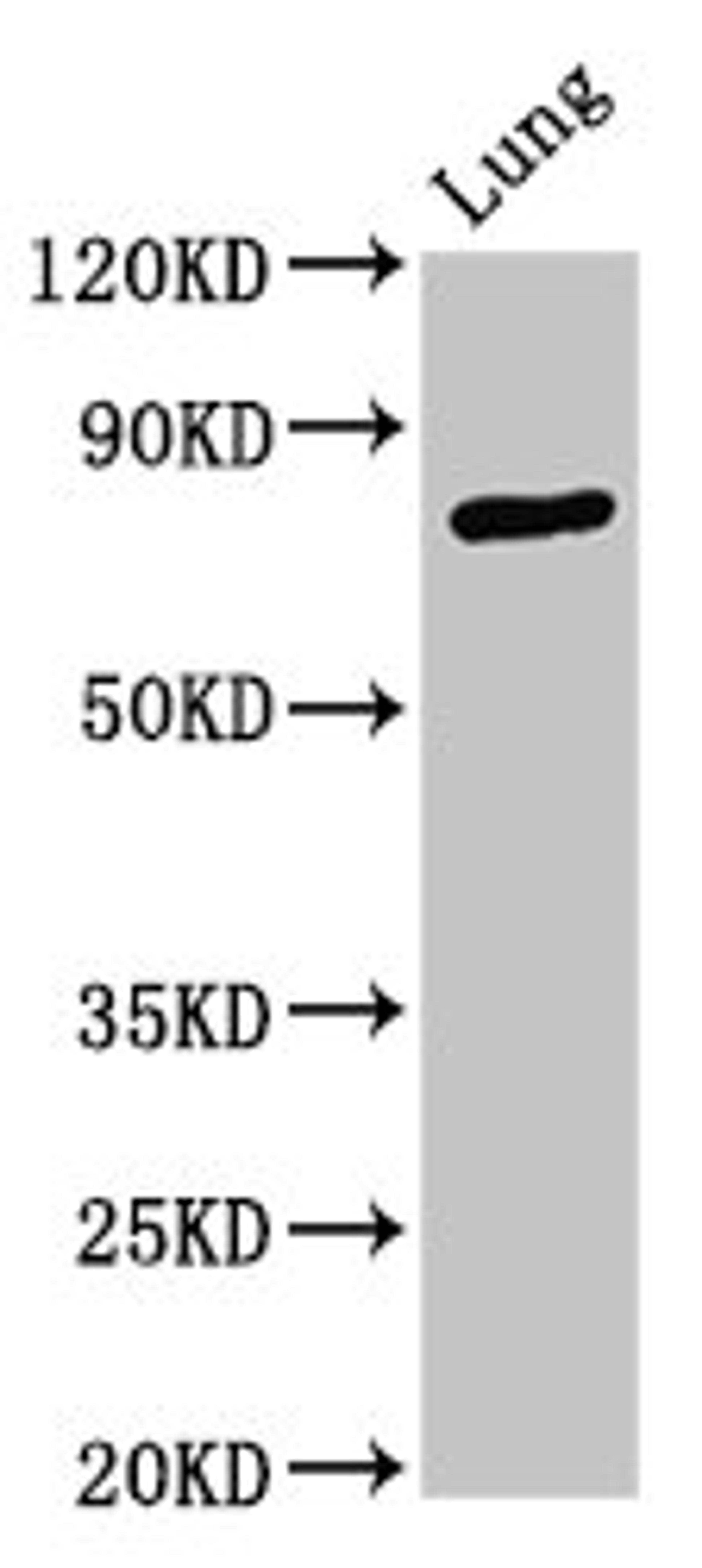 Western Blot. Positive WB detected in: Rat lung tissue. All lanes: ATXN7 antibody at 3.3ug/ml. Secondary. Goat polyclonal to rabbit IgG at 1/50000 dilution. Predicted band size: 96, 102, 80 kDa. Observed band size: 80 kDa.