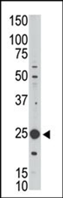 Antibody is used in Western blot to detect MAGEH1 in Jurkat cell lysate.