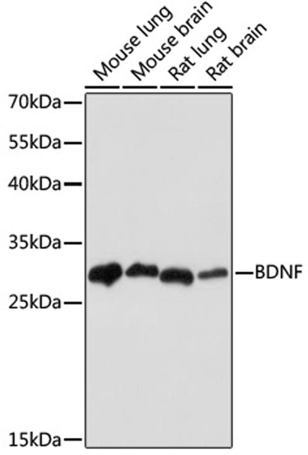 Western blot - BDNF antibody (A18129)