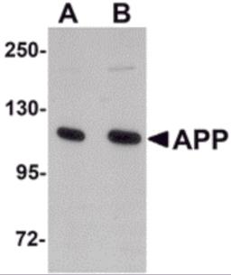 Western blot analysis of APP in rat brain tissue lysate with APP antibody at (A) 1 and (B) 2 &#956;g/mL.