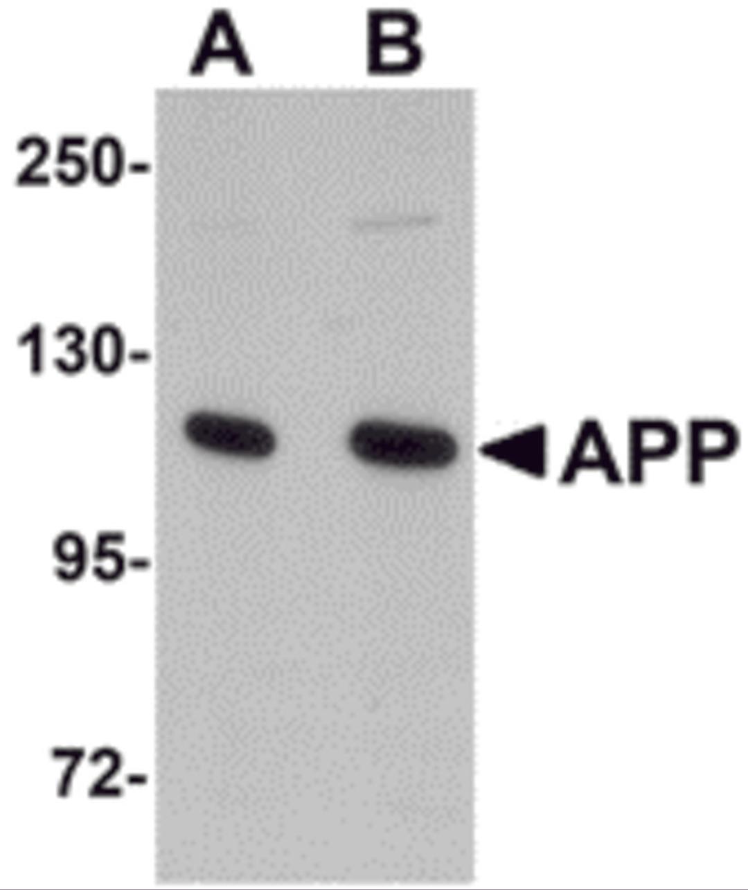 Western blot analysis of APP in rat brain tissue lysate with APP antibody at (A) 1 and (B) 2 μg/mL.