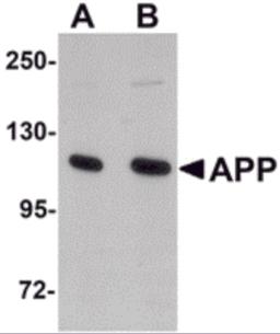 Western blot analysis of APP in rat brain tissue lysate with APP antibody at (A) 1 and (B) 2 μg/mL.