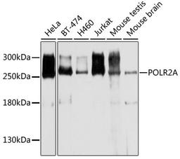 Western blot - POLR2A antibody (A11181)