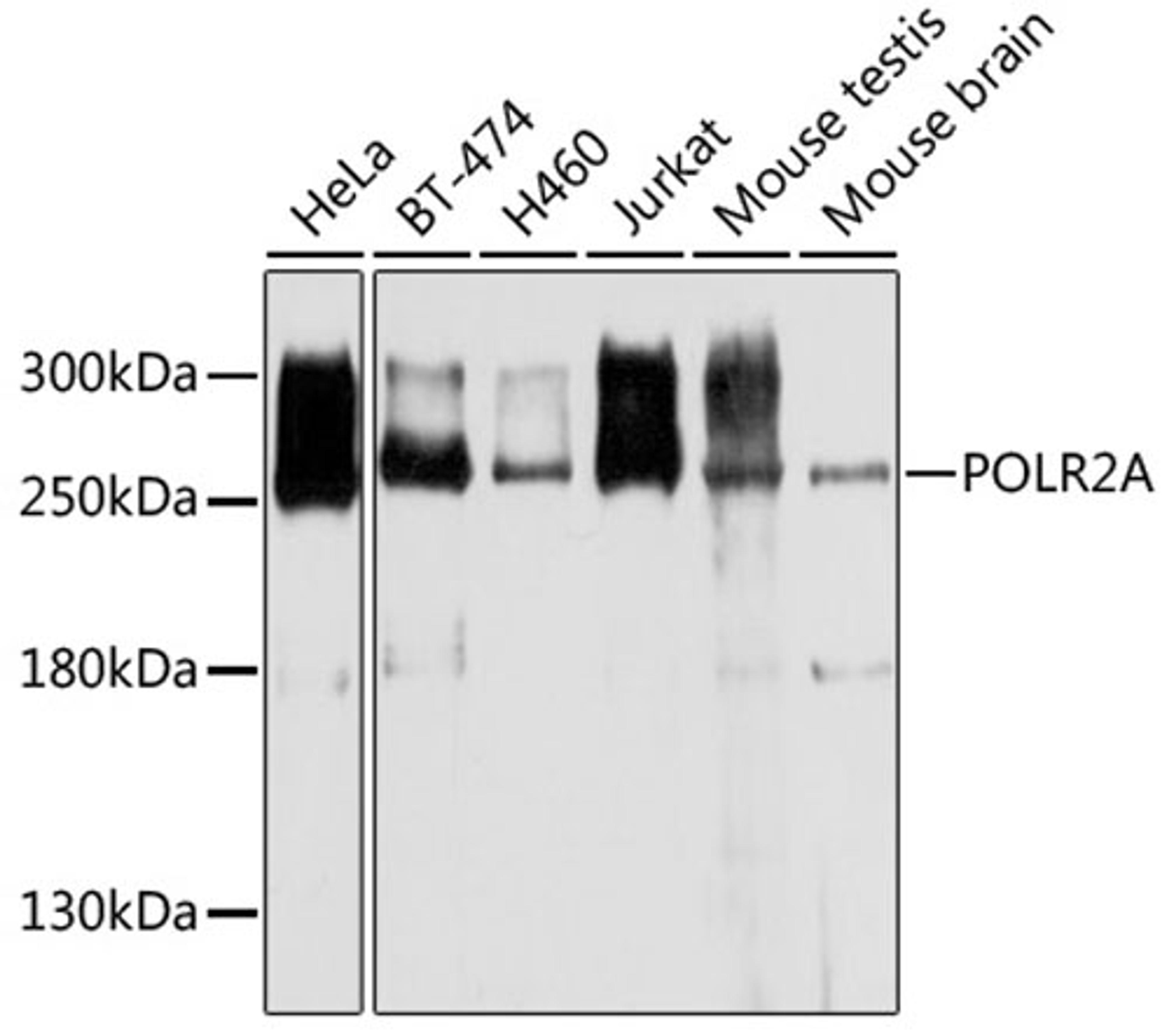 Western blot - POLR2A antibody (A11181)