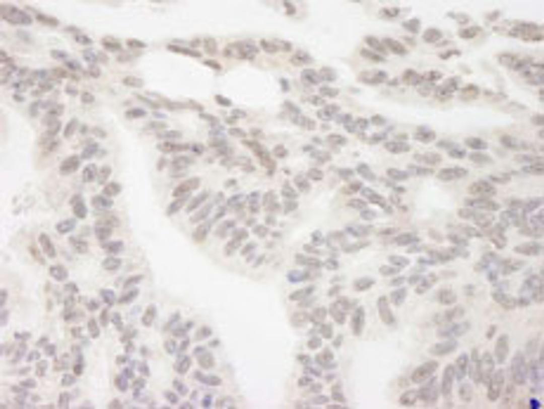 Detection of human RBM12 by immunohistochemistry.