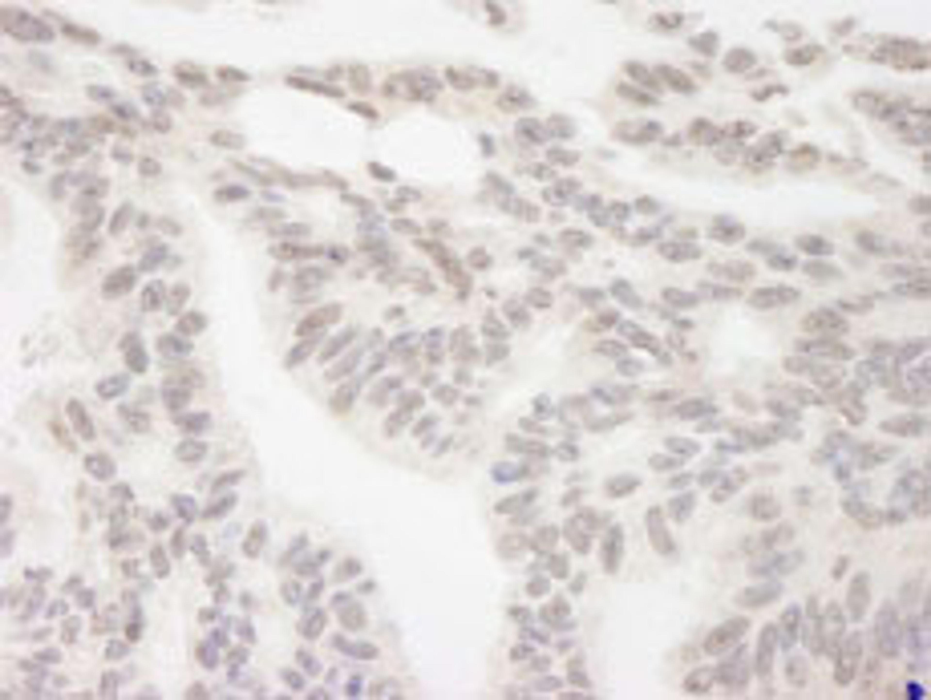 Detection of human RBM12 by immunohistochemistry.