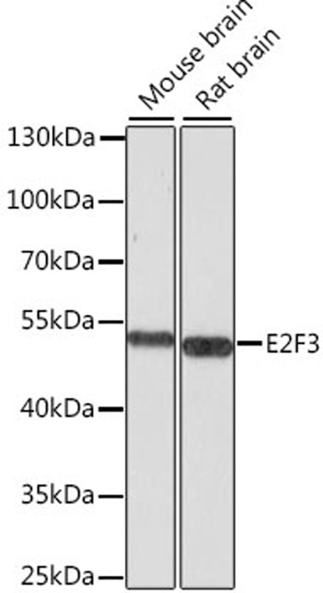 Western blot - E2F3 antibody (A8811)