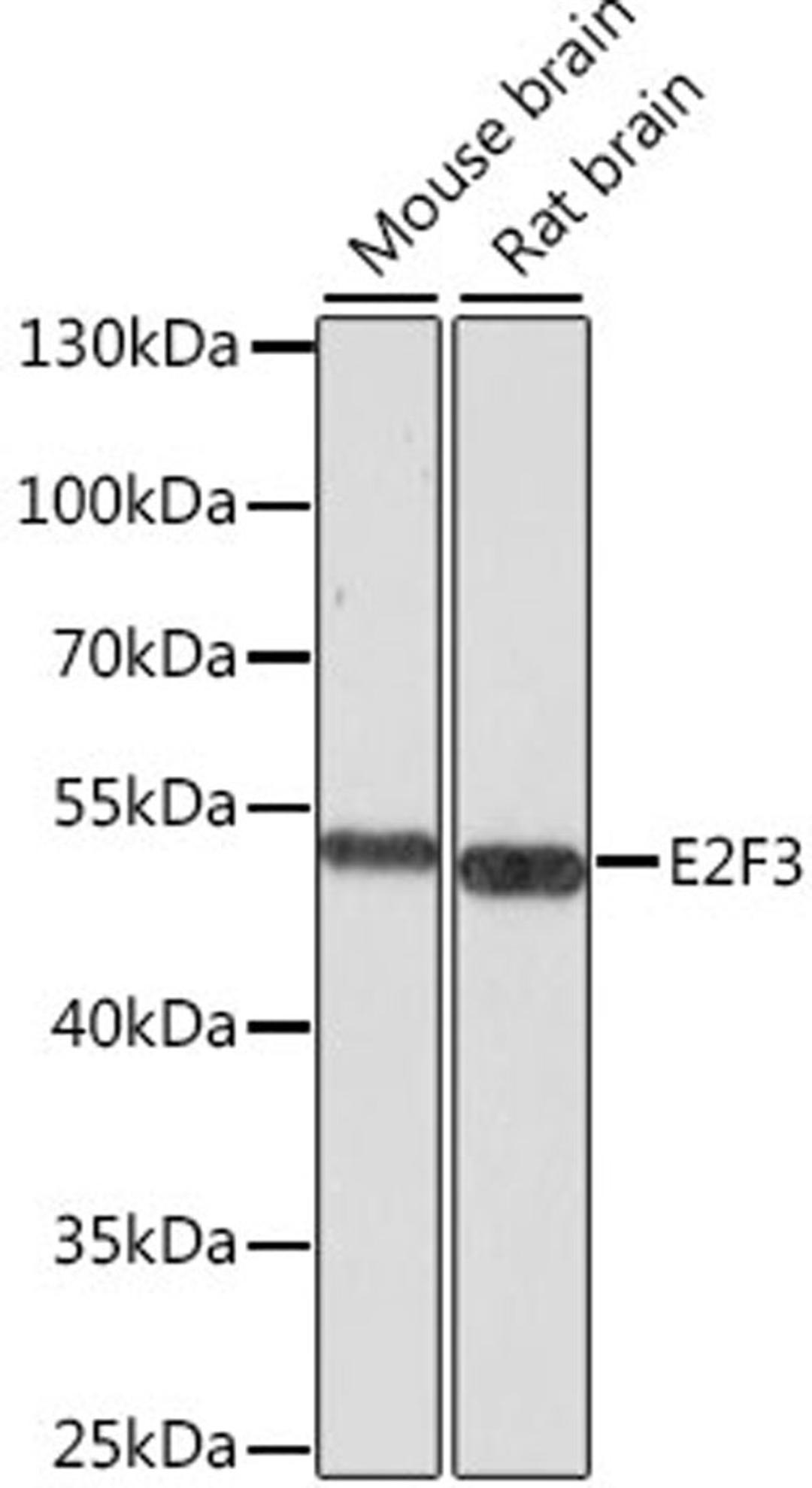 Western blot - E2F3 antibody (A8811)