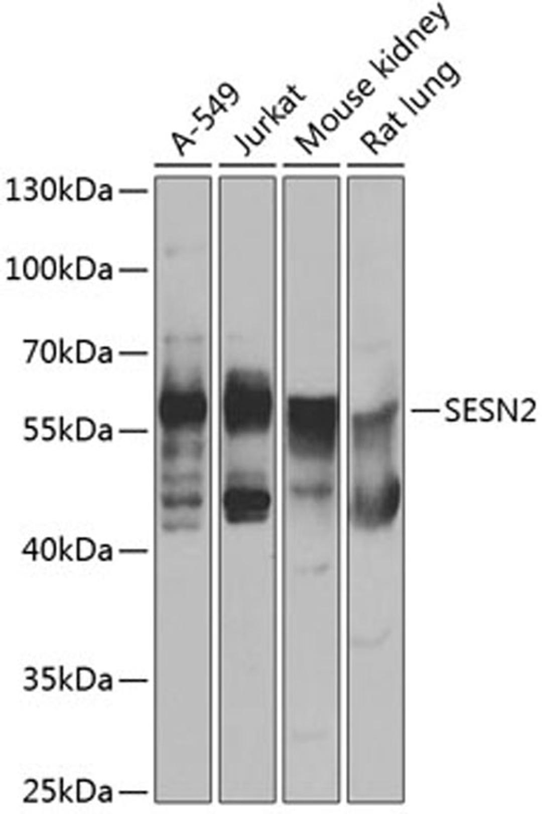 Western blot - SESN2 antibody (A7515)