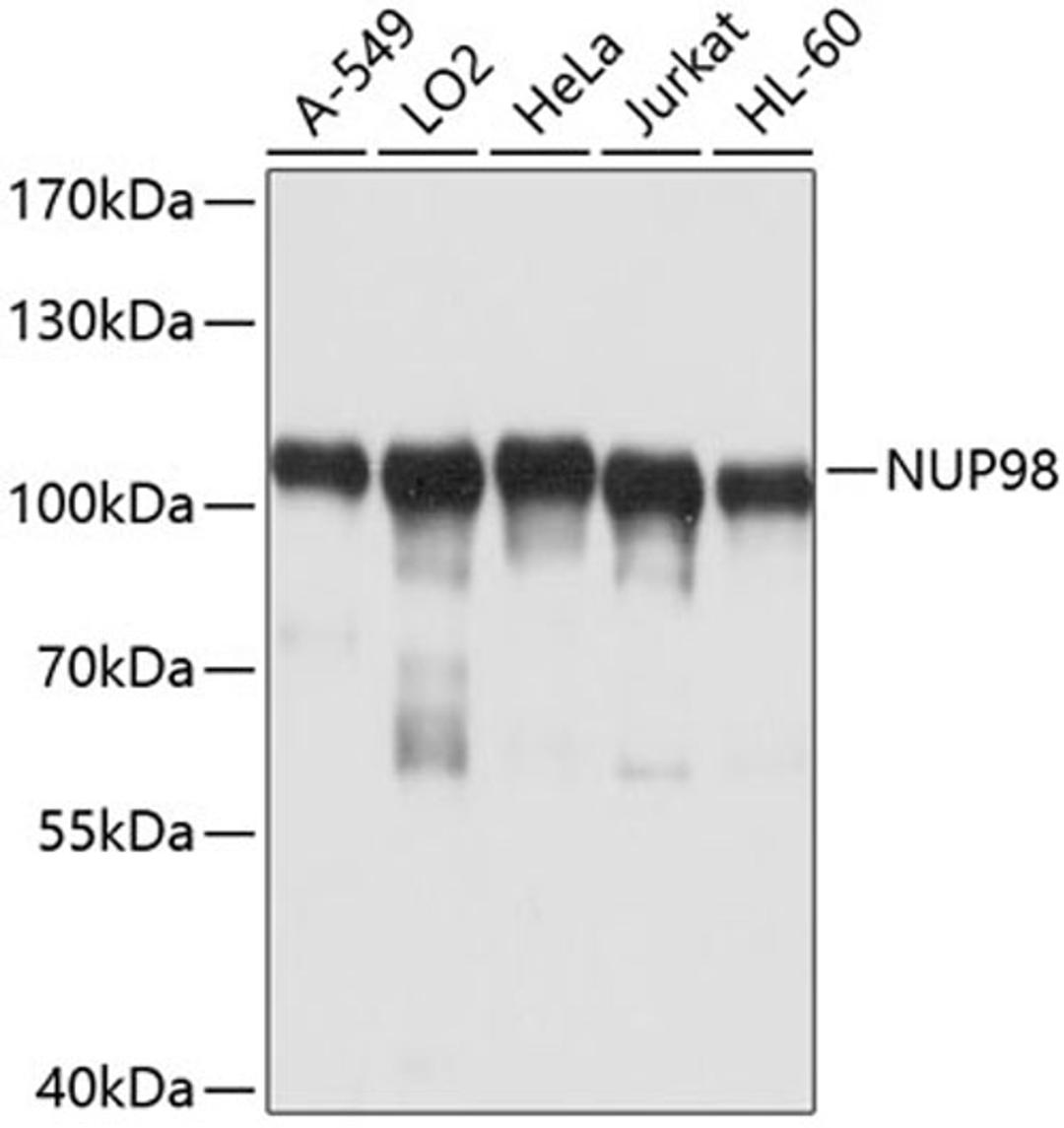 Western blot - NUP98 antibody (A0530)