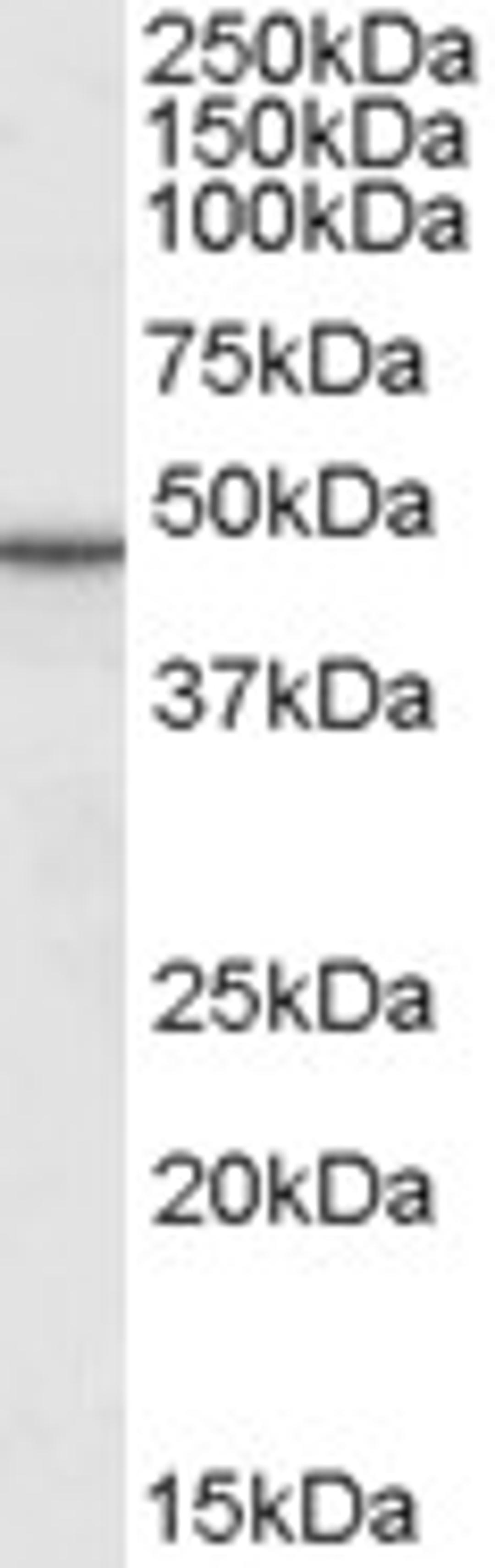 45-852 (0.1ug/ml) staining of Rat Skin lysate (35ug protein in RIPA buffer). Primary incubation was 1 hour. Detected by chemiluminescence.