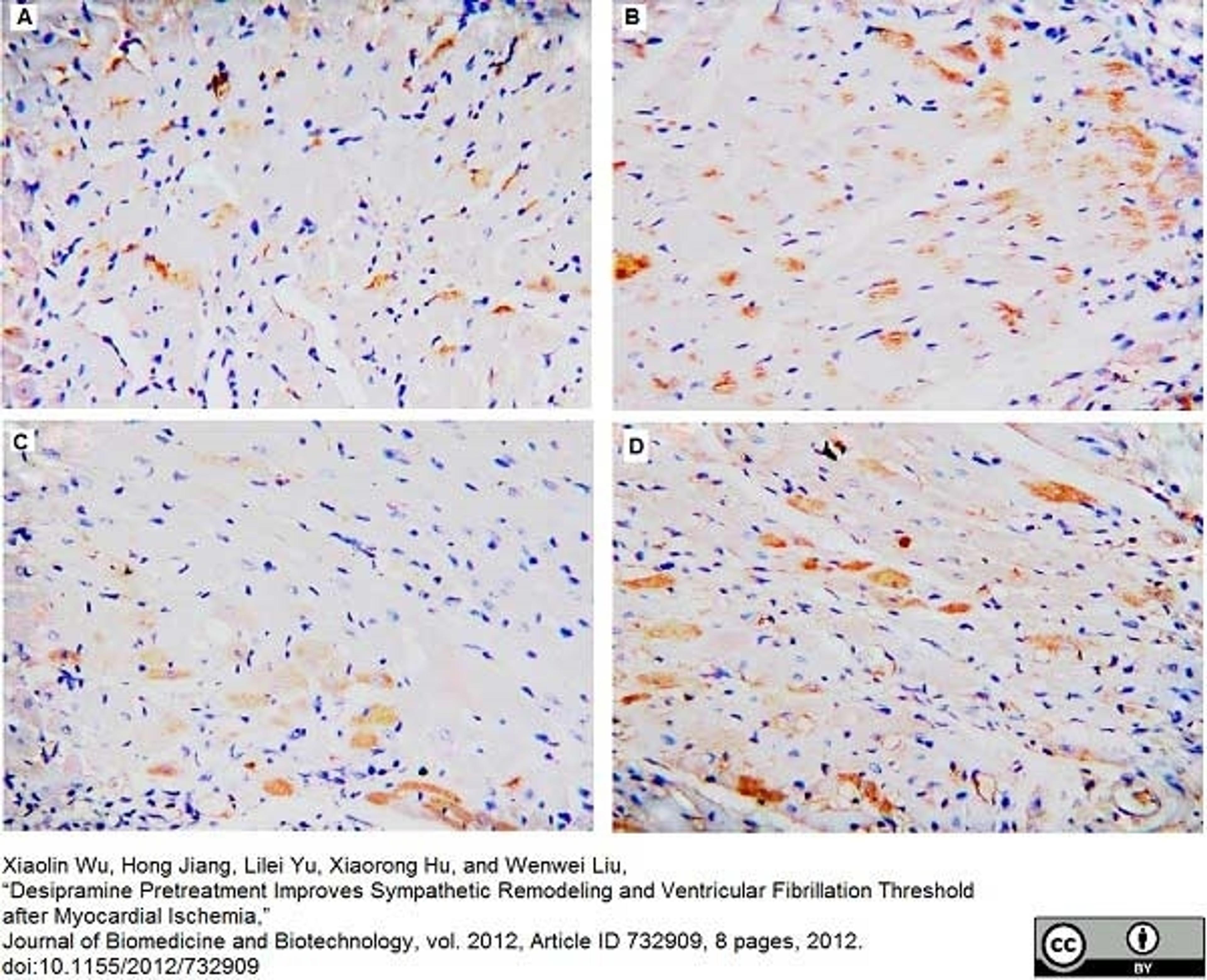 Rabbit anti GAP43 used to demonstrate GAP43 expression in nerve fibers in a rat myocardial ischemia
