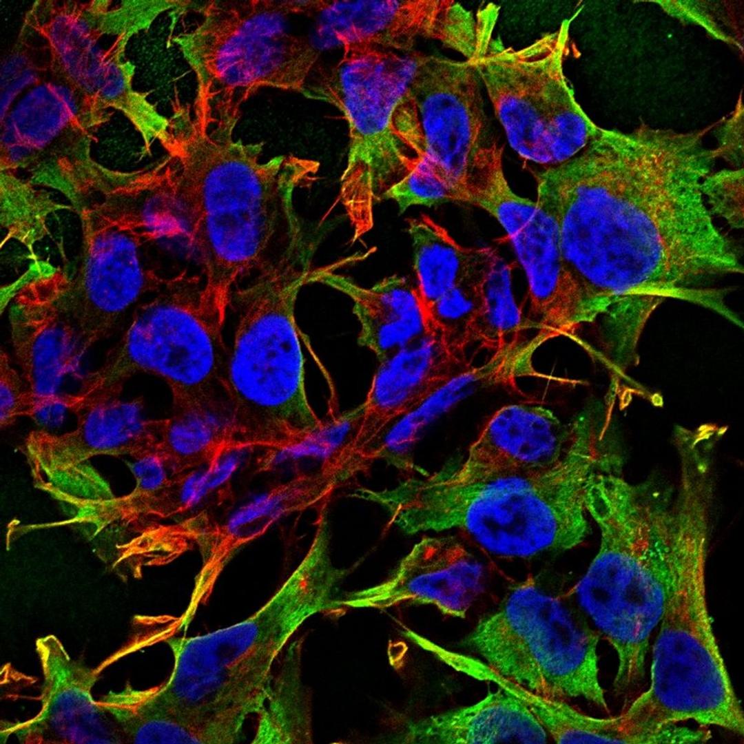 Immunofluorescence analysis of neuroblastoma cell line sk-n-be using Neuroligin 3 antibody