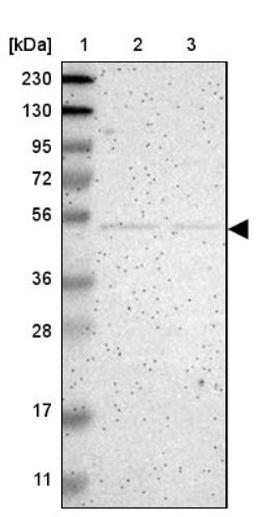 Western Blot: NETO2 Antibody [NBP1-84624] - Lane 1: Marker [kDa] 230, 130, 95, 72, 56, 36, 28, 17, 11<br/>Lane 2: Human cell line RT-4<br/>Lane 3: Human cell line U-251MG sp