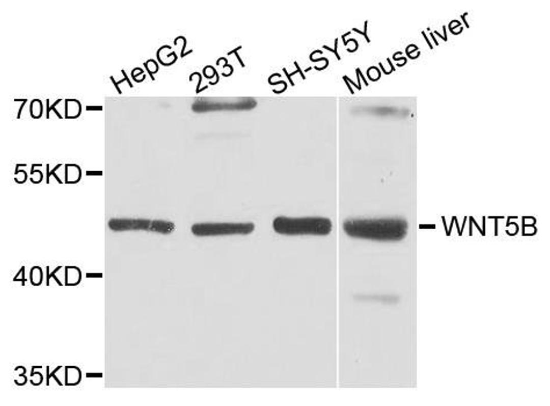 Western blot analysis of extract of various cells using WNT5B antibody