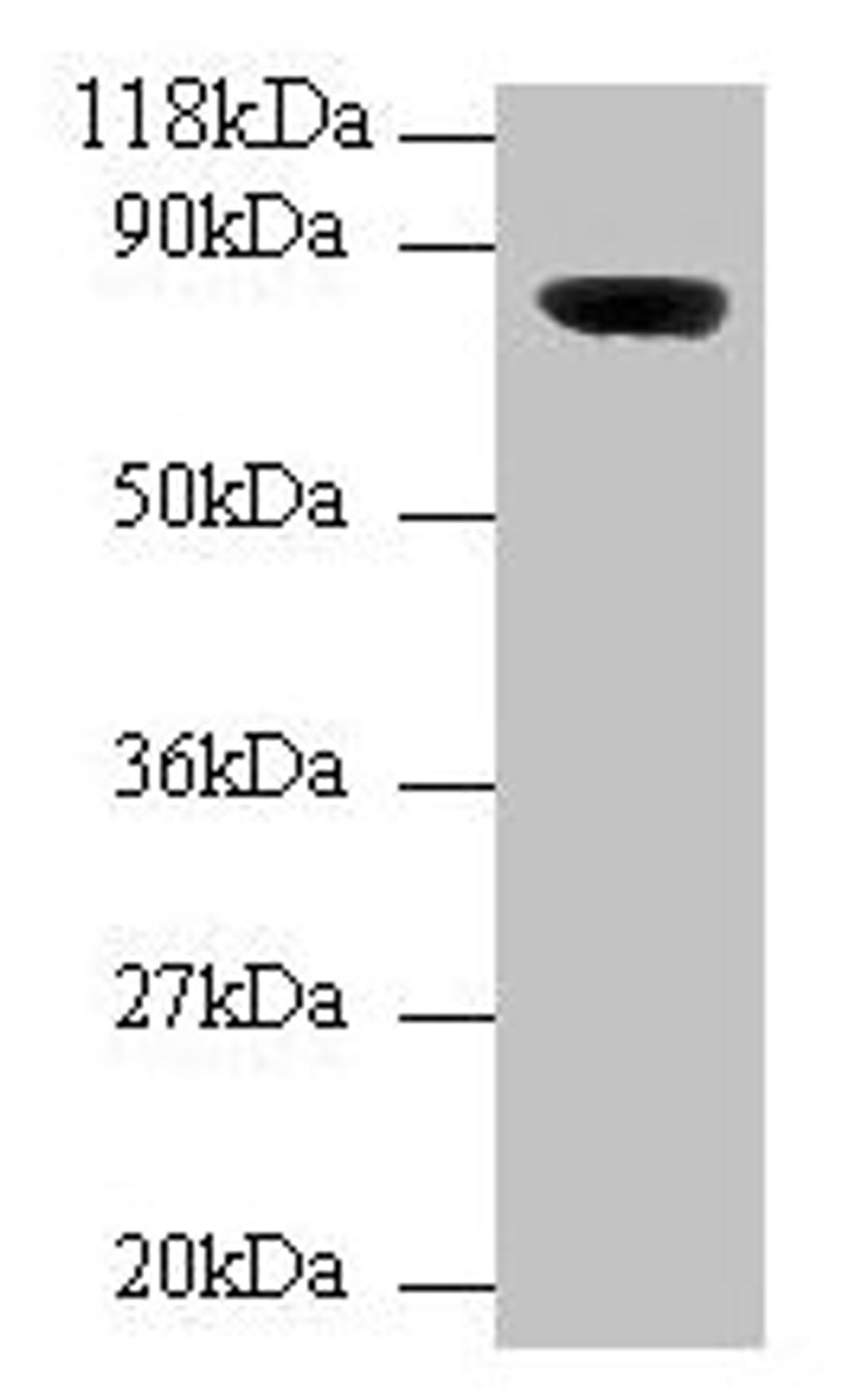 Western blot. All lanes: Wdpcp antibody at 2µg/ml + Mouse brain tissue. Secondary. Goat polyclonal to rabbit IgG at 1/10000 dilution. Predicted band size: 82, 73 kDa. Observed band size: 82 kDa