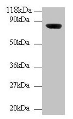Western blot. All lanes: Wdpcp antibody at 2µg/ml + Mouse brain tissue. Secondary. Goat polyclonal to rabbit IgG at 1/10000 dilution. Predicted band size: 82, 73 kDa. Observed band size: 82 kDa