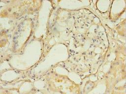 Immunohistochemistry of paraffin-embedded human kidney tissue using CSB-PA006930LA01HU at dilution of 1:100