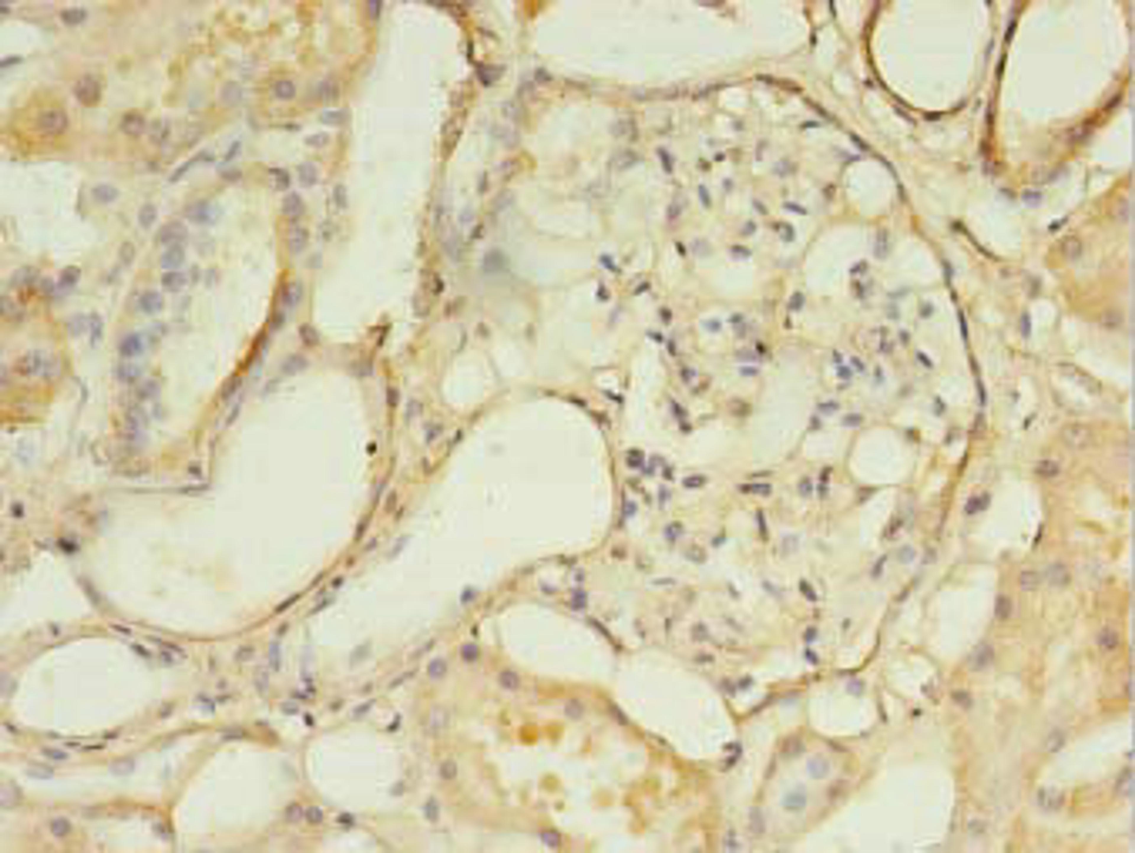 Immunohistochemistry of paraffin-embedded human kidney tissue using CSB-PA006930LA01HU at dilution of 1:100