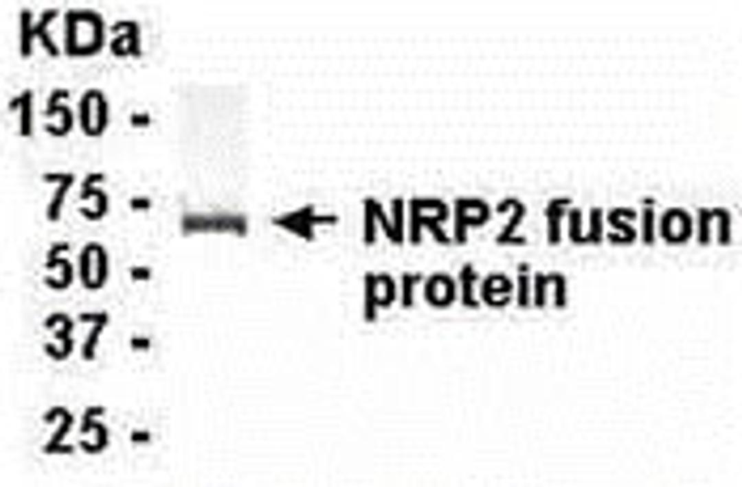 E coli-derived fusion protein as test antigen. Affinity-purified IgY dilution: 1:2000, Goat anti-IgY-HRP dilution: 1:1000. Colorimetric method for signal development.