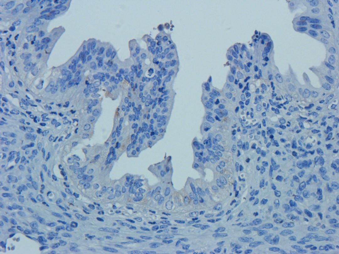 Immunohistochemical staining of rat colon tissue using Claudin 5 antibody (2.5 ug/ml)