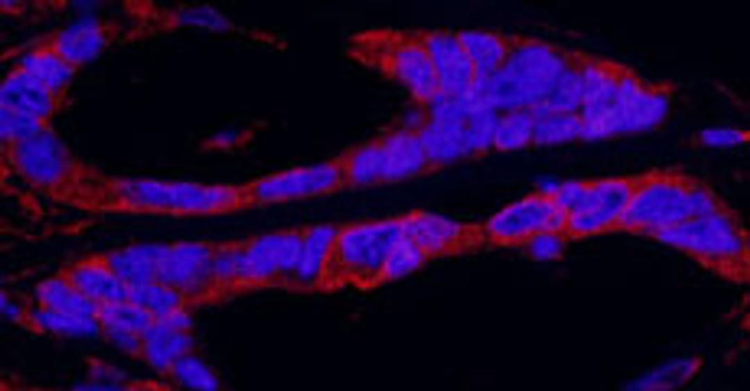 Detection of human RSK1 by immunohistochemistry.