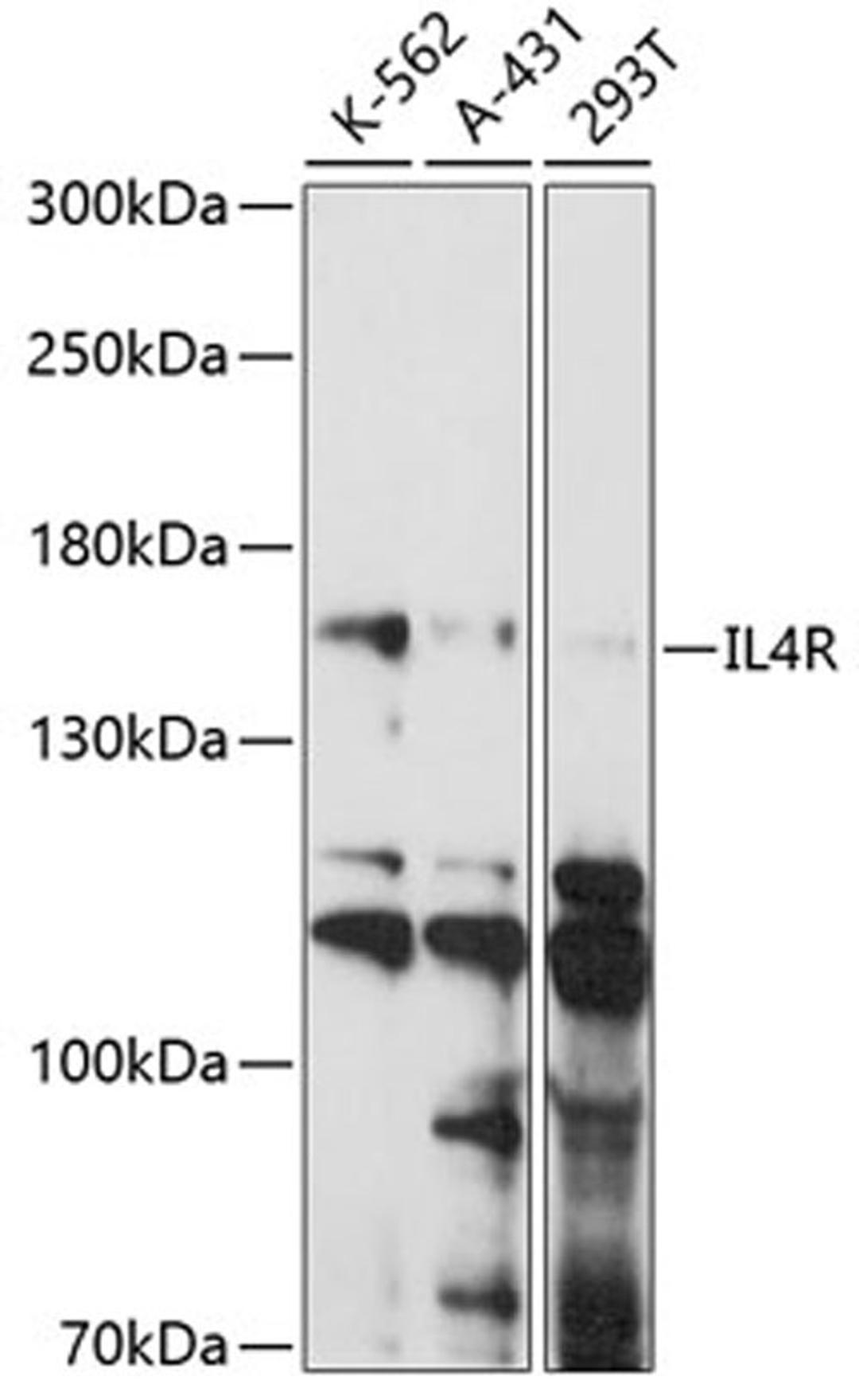 Western blot - IL4R antibody (A14648)